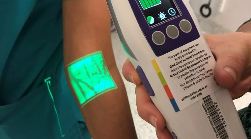 Augmented Reality Medical Examples Accuvein AR Vein Location