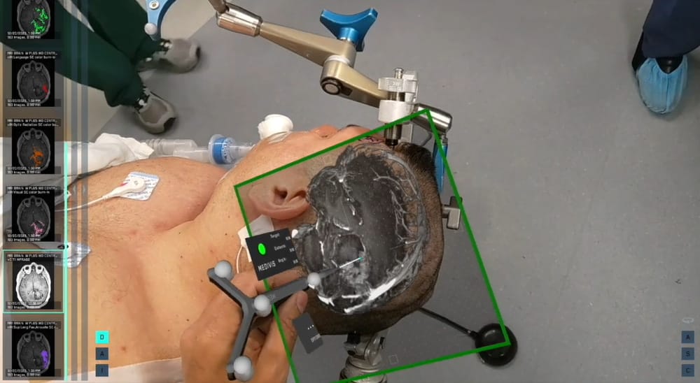 Augmented Reality Medical Examples Medivis AR Surgery